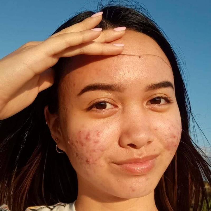 揭秘油腻女生的真相（你中招了吗）-第1张图片-爱昵情感