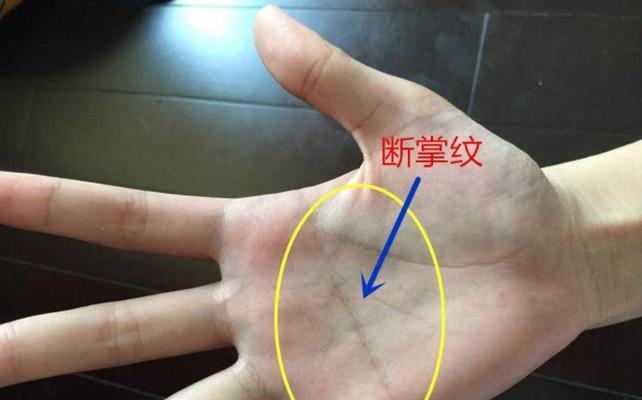 男人双手断掌纹好吗？断掌纹对性格和命运有何影响？-第1张图片-爱昵情感