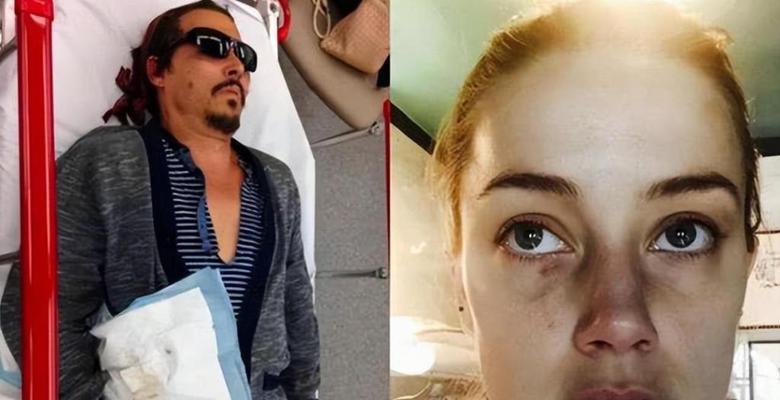 如何挽回因家暴而离婚的妻子？挽回过程中应注意哪些问题？-第1张图片-爱昵情感
