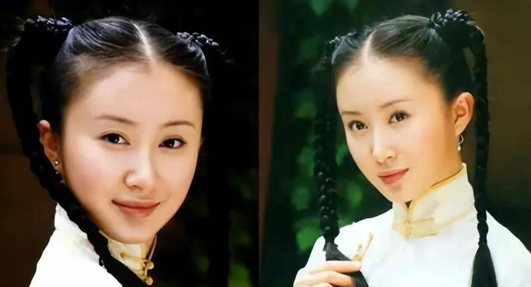 女生整容过度真的不好吗？如何避免整容风险？-第3张图片-爱昵情感